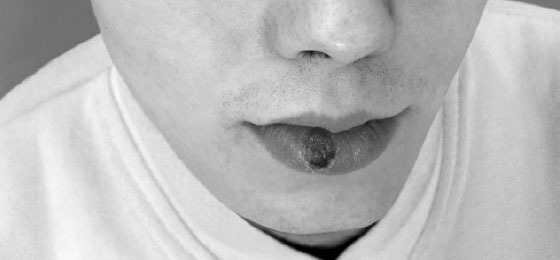 Hautarzt in Zürich für professionelle dermatologische